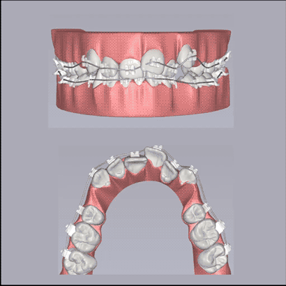 Treatment simulation animation