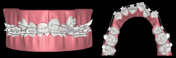Treatment simulation animation